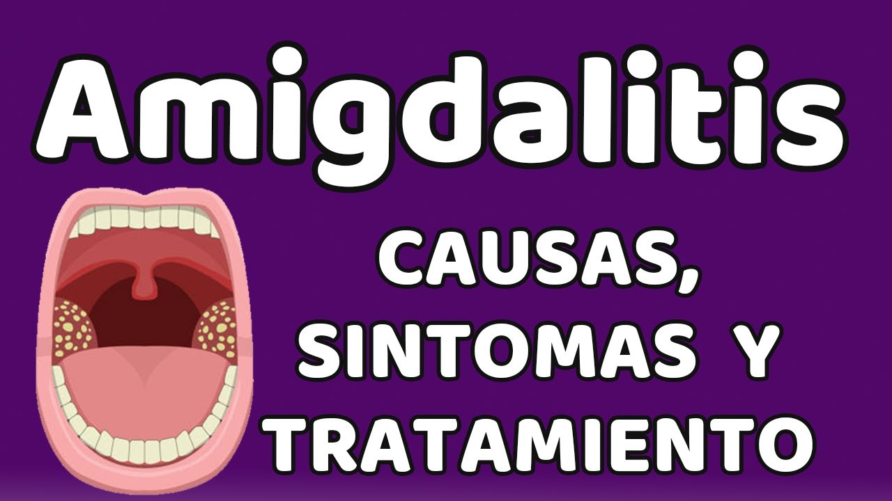 amigdala derecha inflamada con puntos blancos