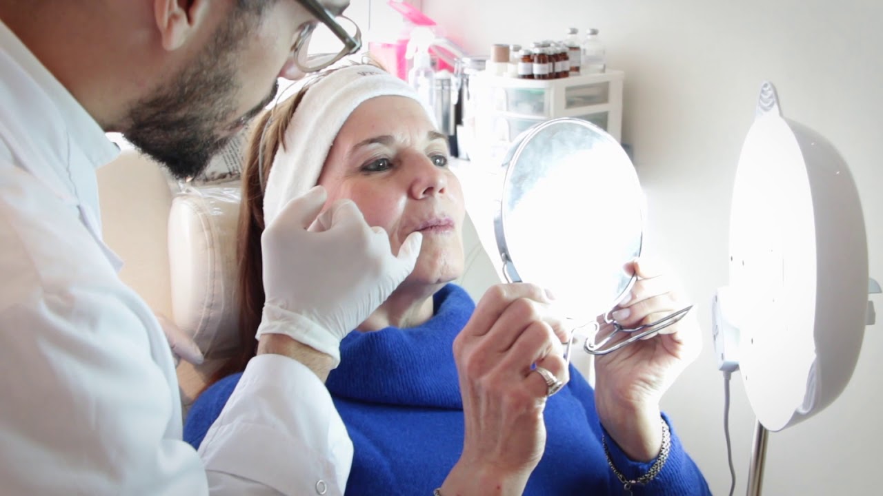 botox y acido hialuronico a la vez