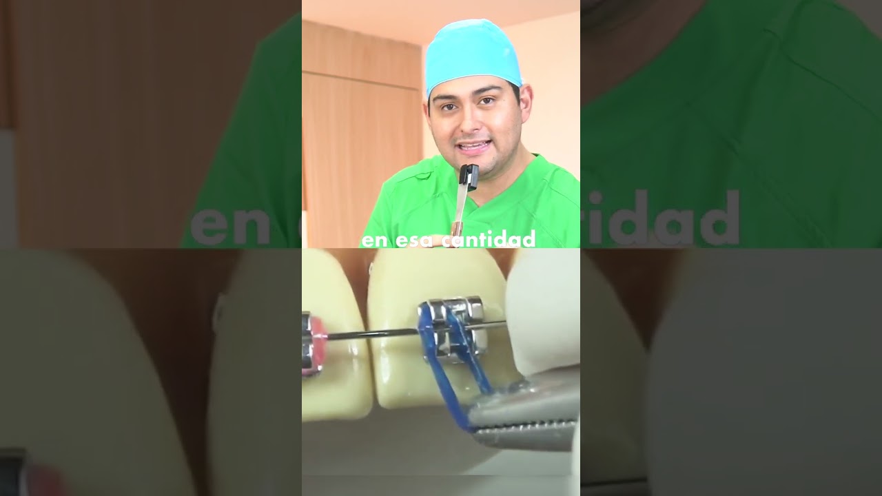 cada cuanto se cambian las gomas de los brackets