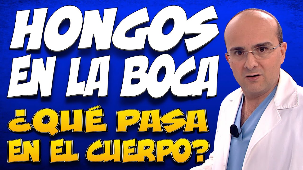 como quitar los hongos de la garganta