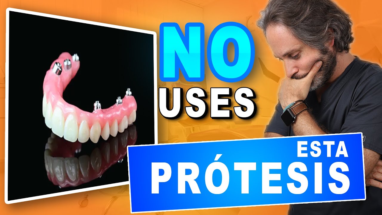 diferencias entre prótesis de porcelana y prótesis híbrida sobre implantes