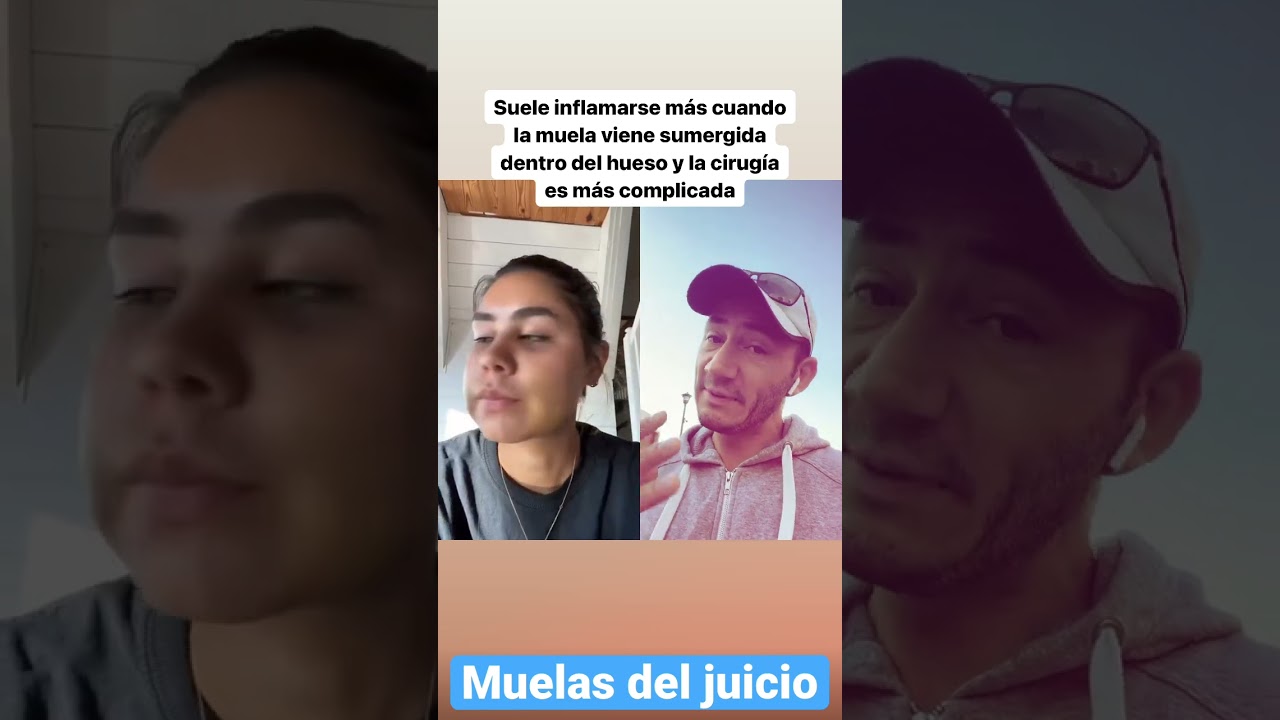 dolor de cabeza extraccion muela del juicio