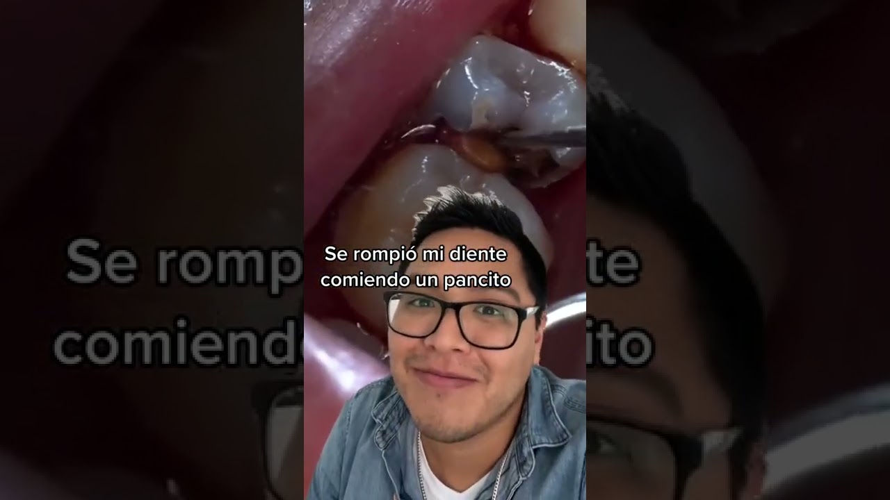 dolor muela al morder algo duro