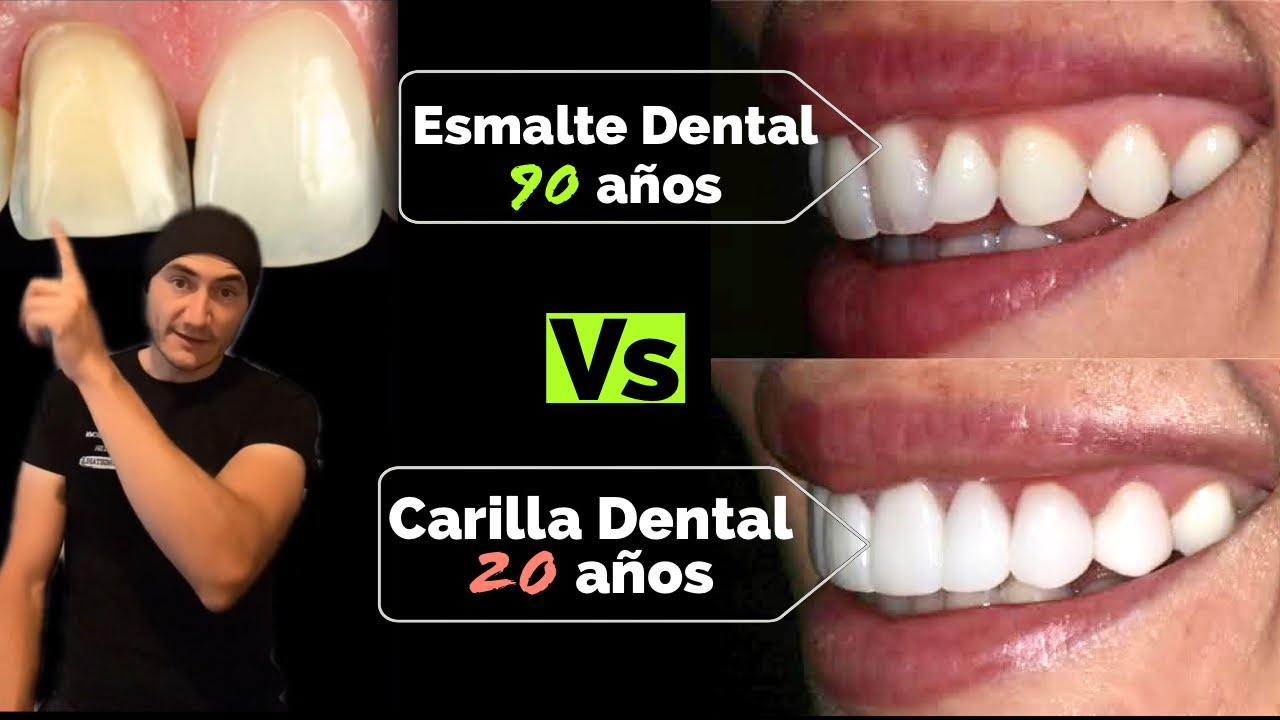 el esmalte de los dientes se regenera