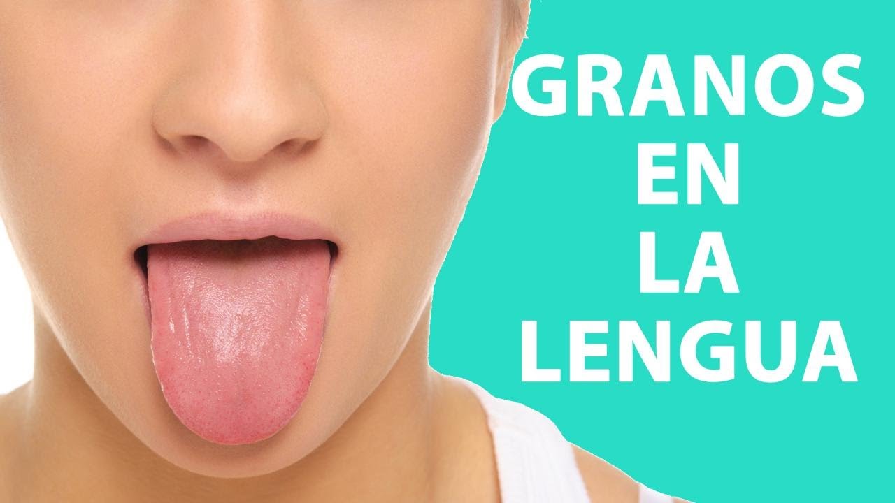 granos en la lengua remedios caseros
