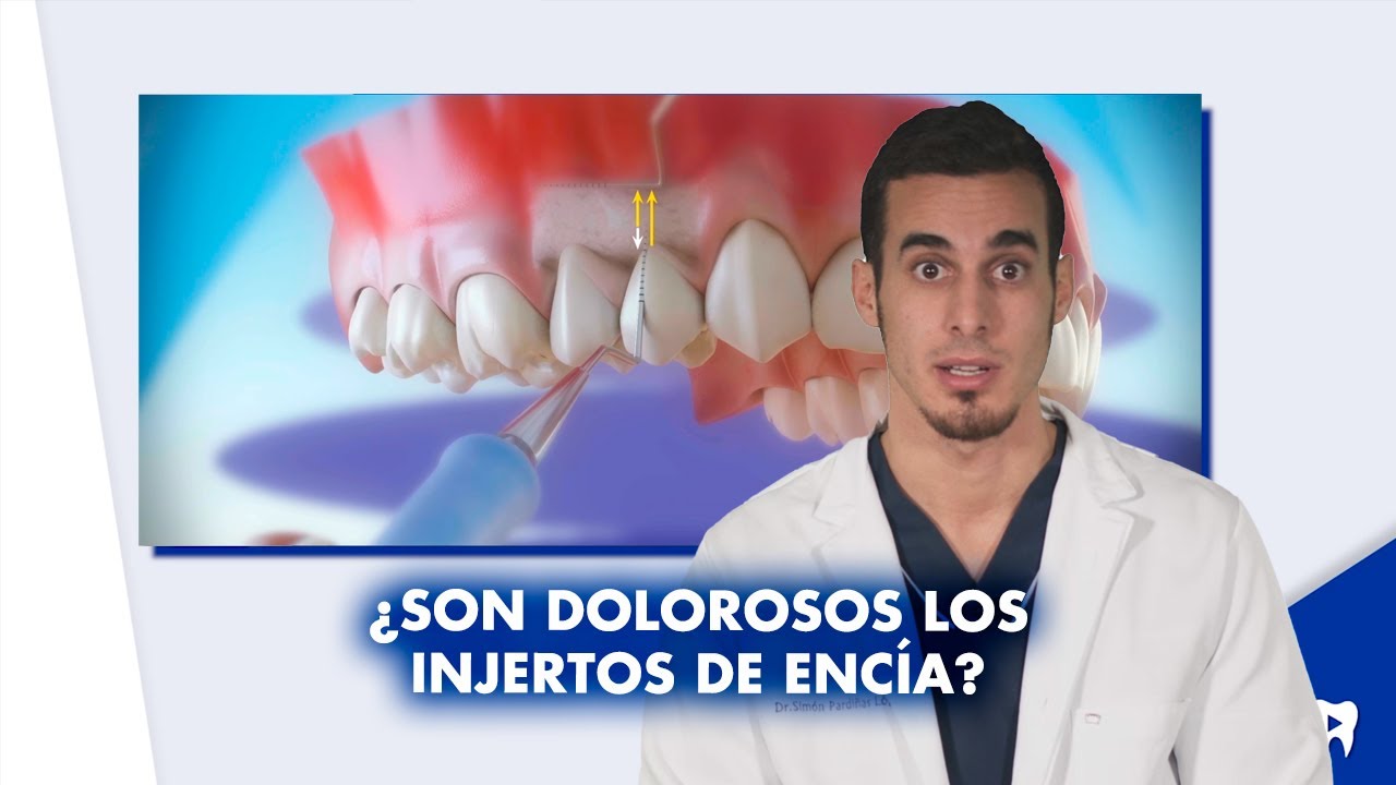 injerto de encía es muy doloroso