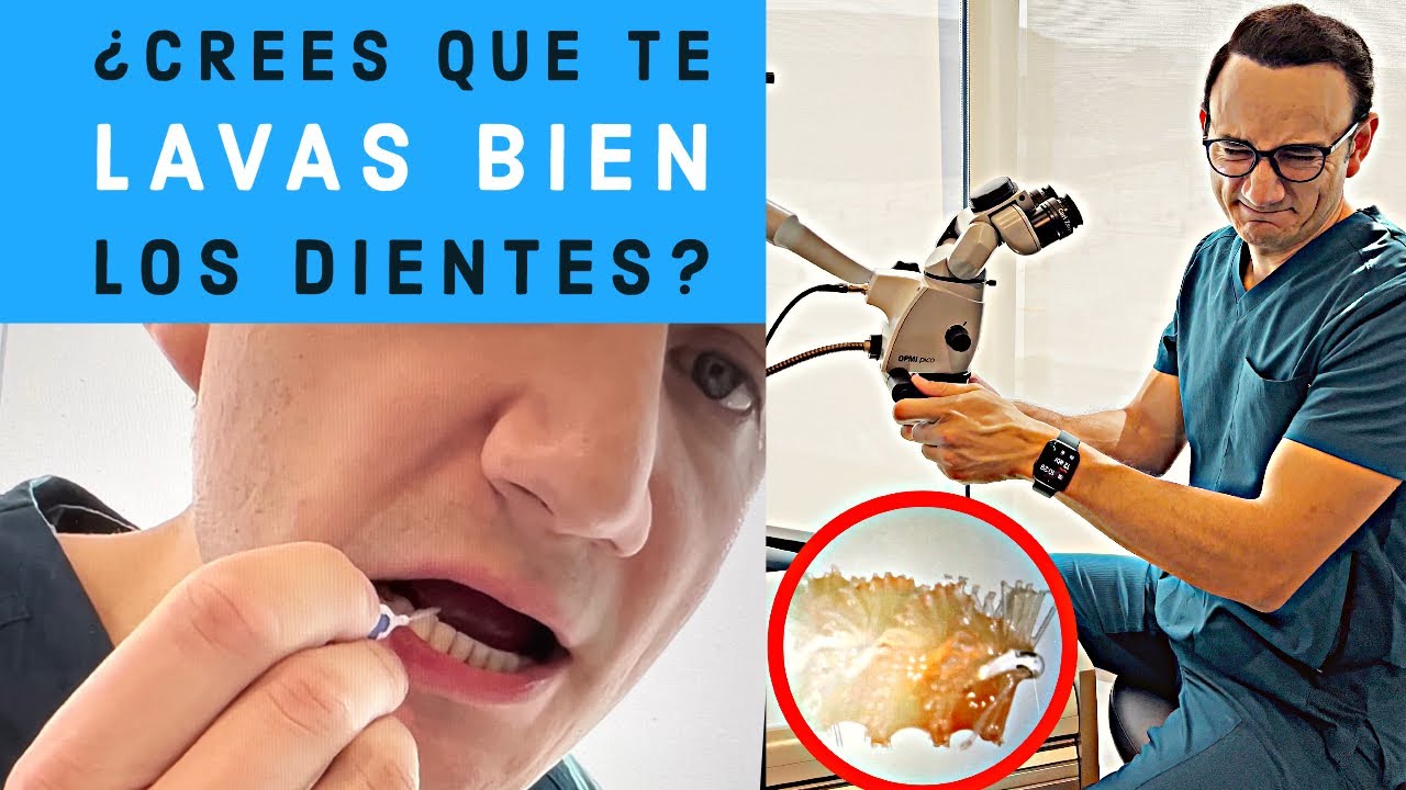 mal olor entre dientes y encías