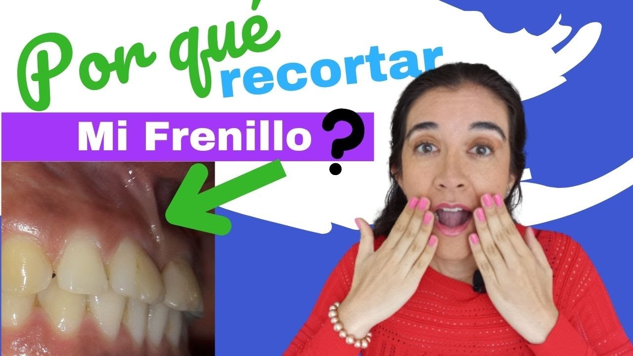 para que sirve el frenillo de la boca