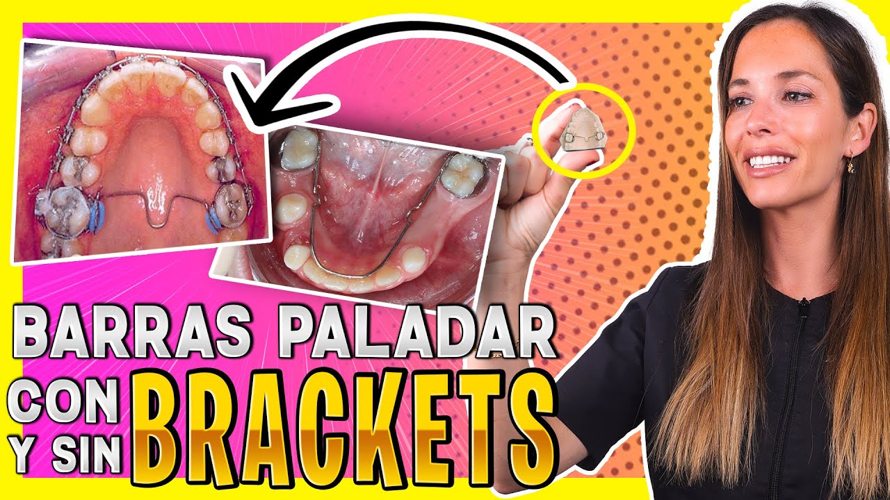 para que sirve el paladar dental