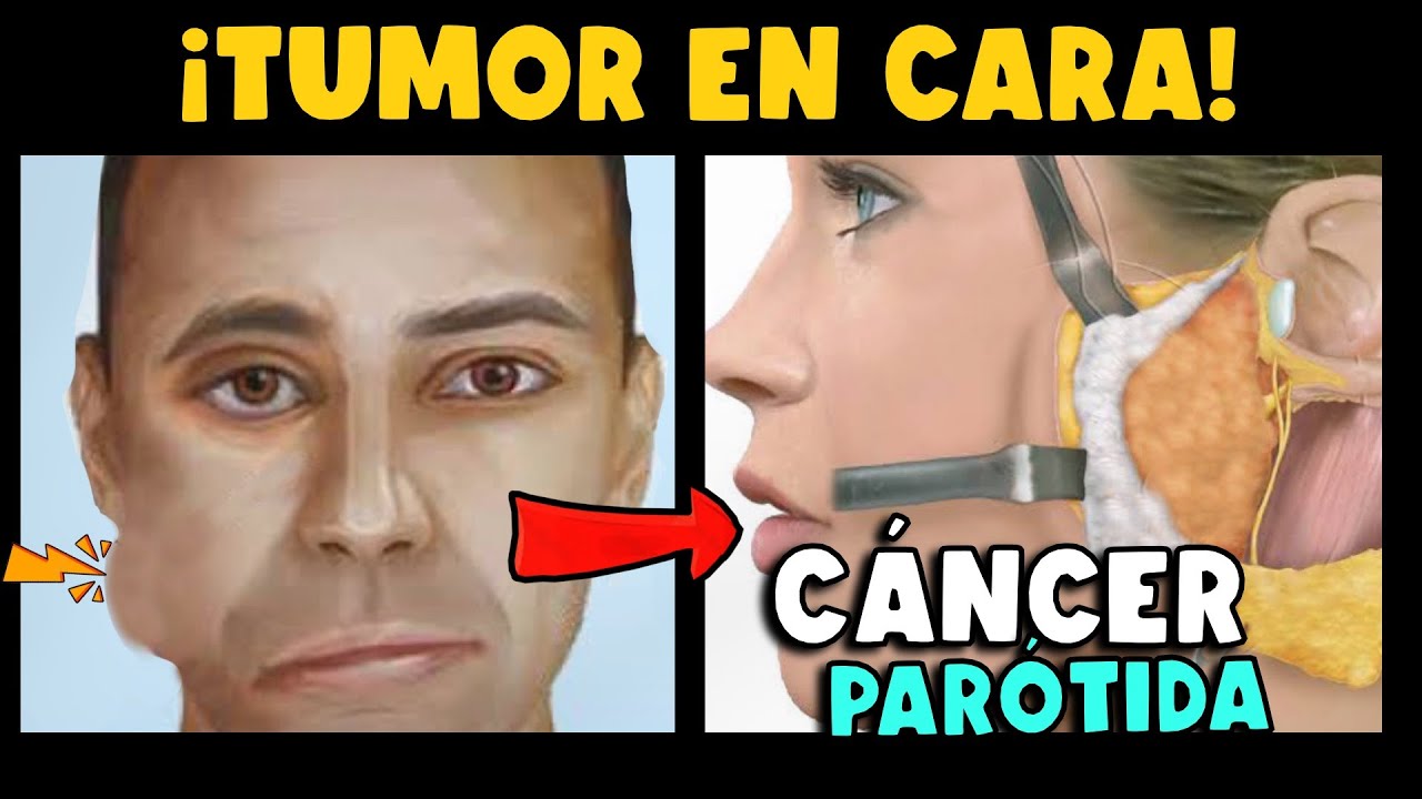 porque me salio una bola en el cachete