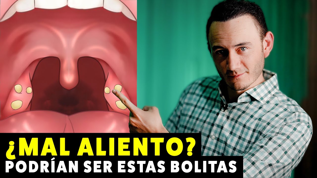 porque salen granos en la garganta