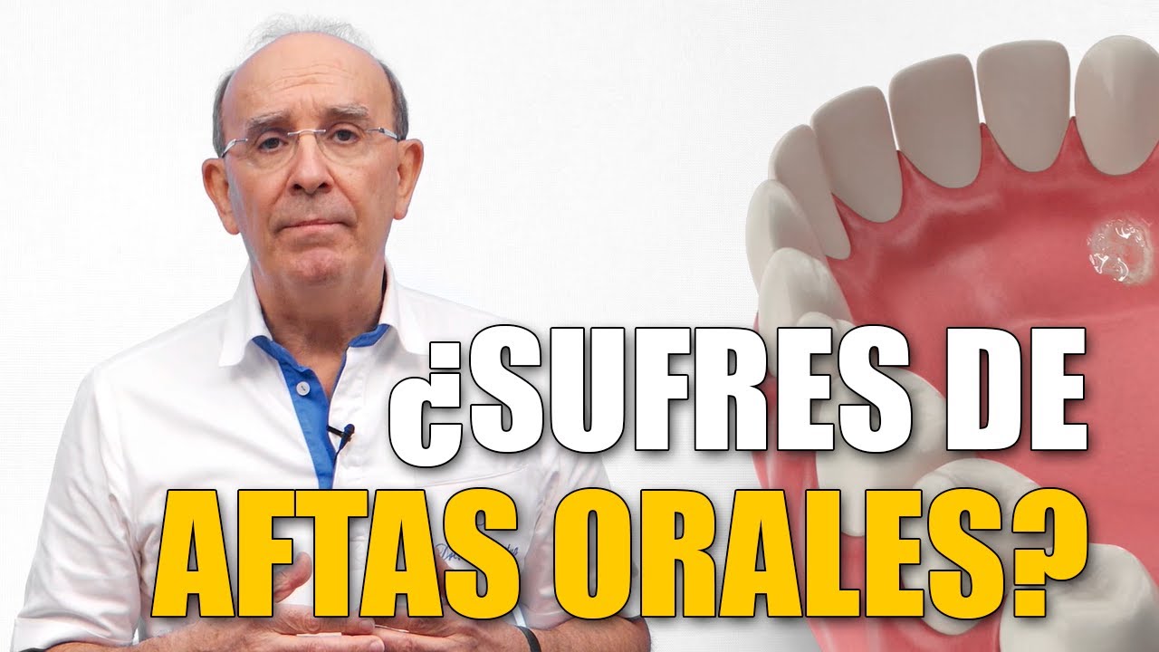 porque salen llagas en el paladar