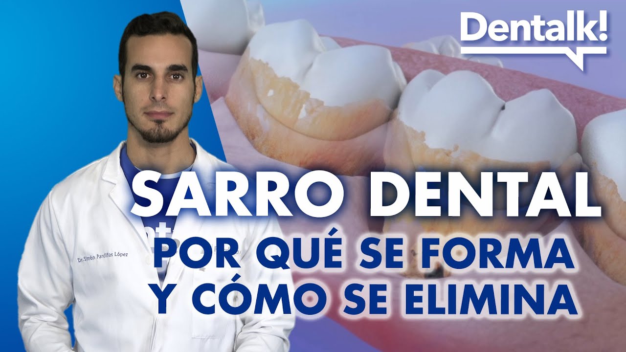 porque se produce el sarro en los dientes