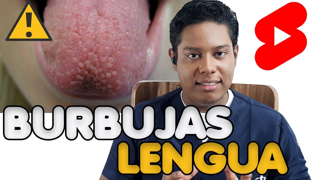 que significa granos en la lengua