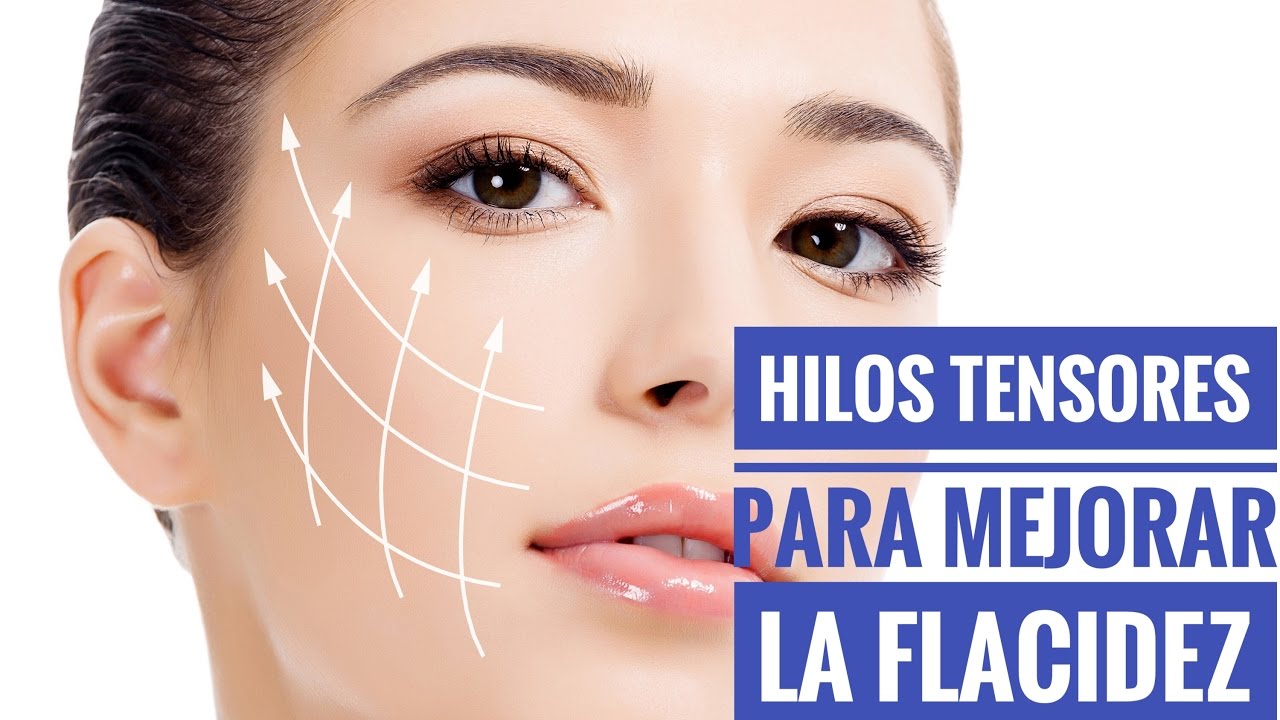 que son los hilos tensores en la cara