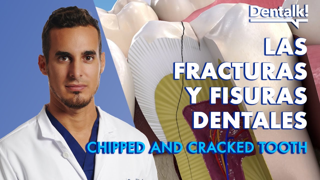 se me rompen los dientes por abajo