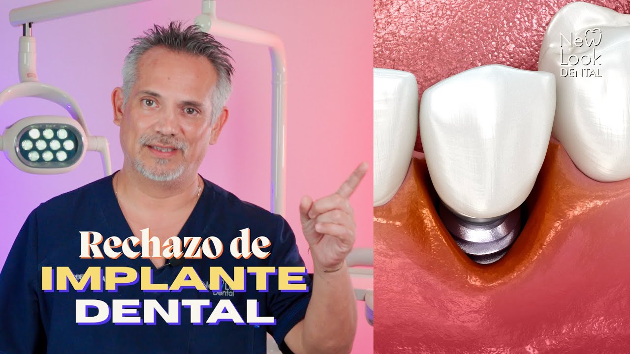 síntomas de rechazo de implante dental