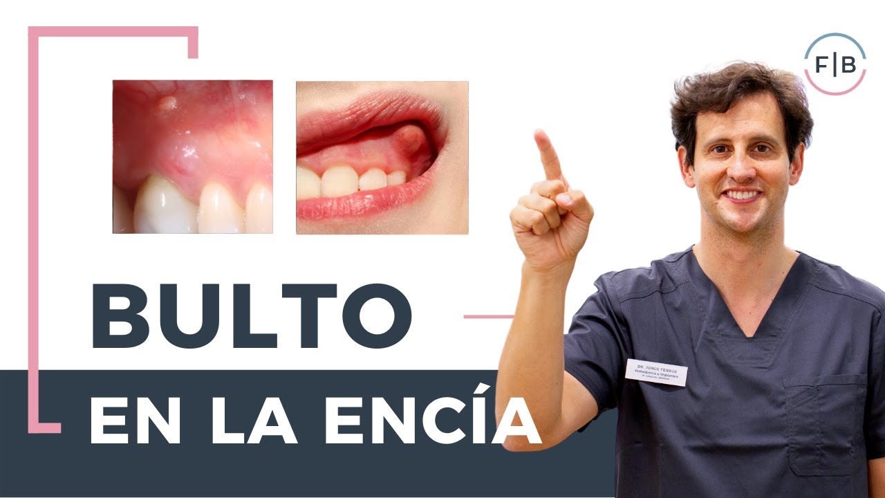 bolita en la muela del juicio