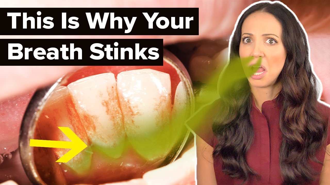 can decayed tooth cause bad breath