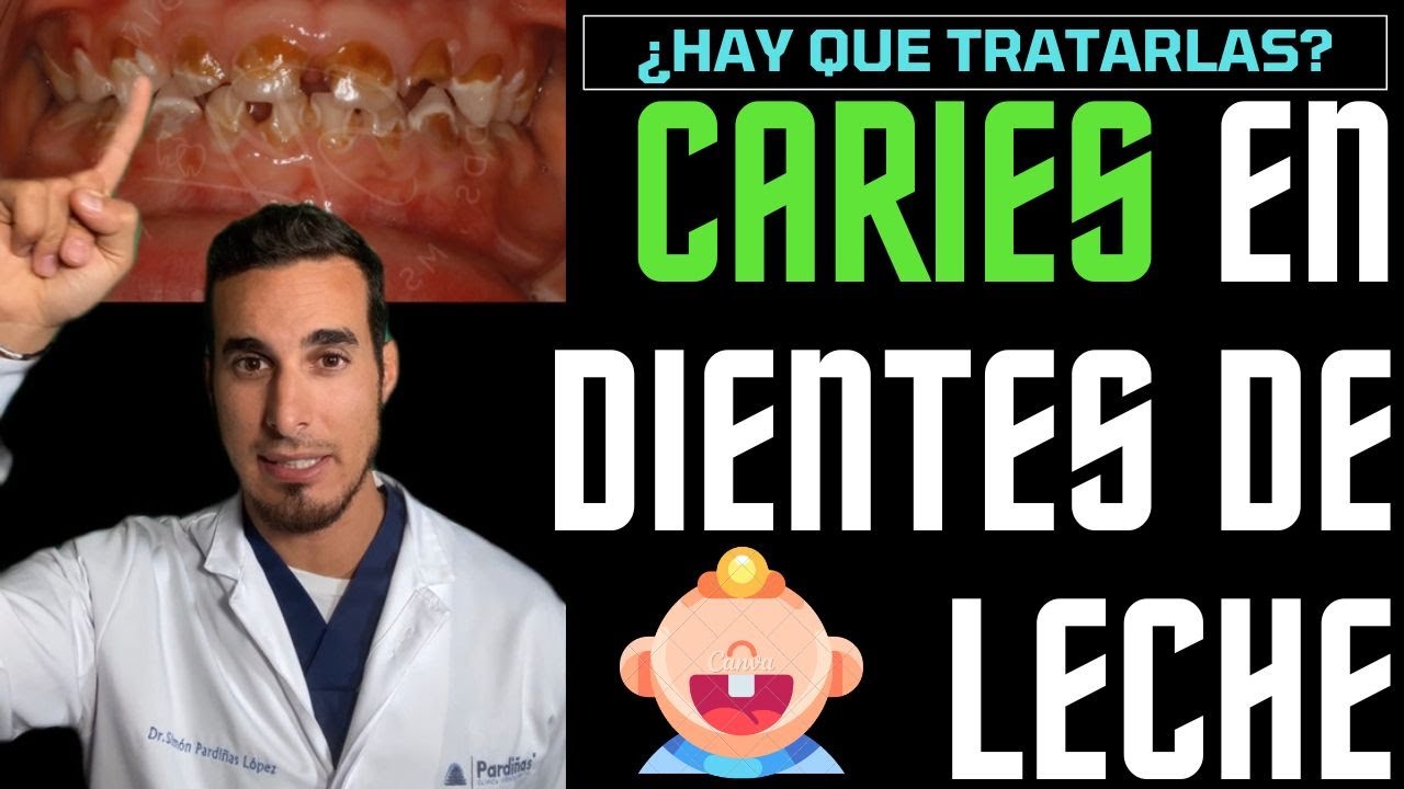 caries en niños de 2 a 5 años