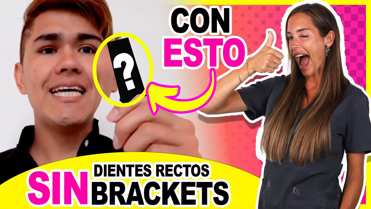 como arreglar dientes apiñados sin ortodoncia