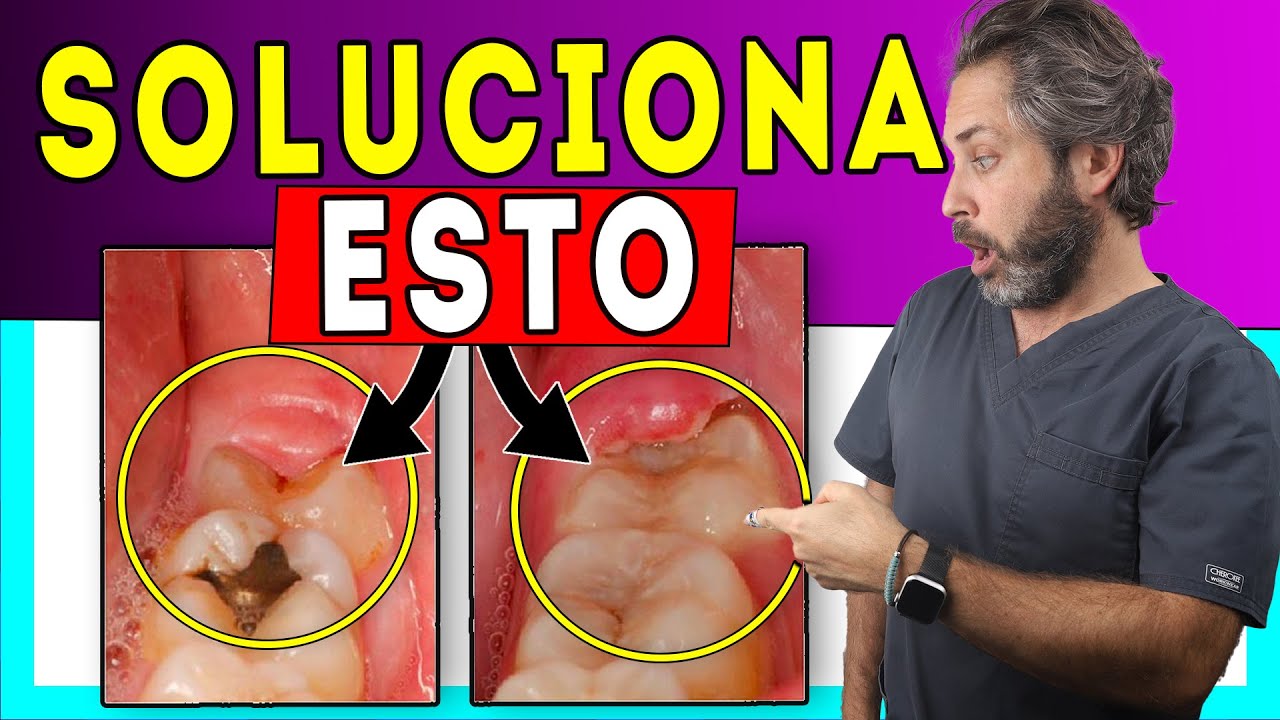 como desinflamar la encia de la muela del juicio