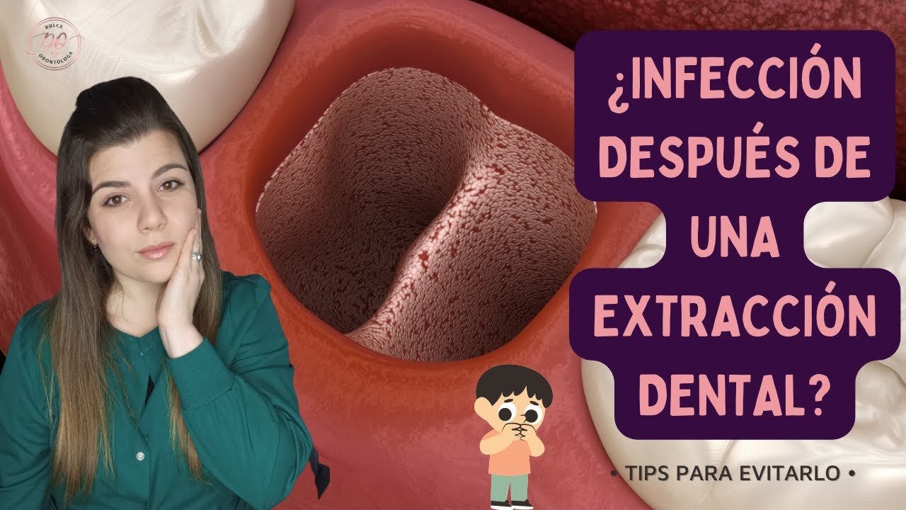 como saber si mi cirugia de muela esta infectada