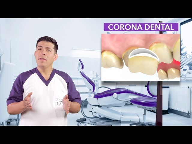 como se pone una funda dental