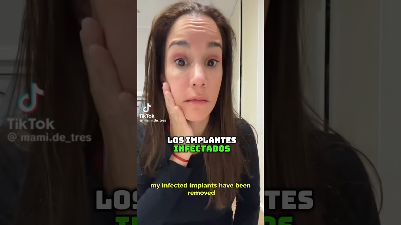 consecuencias al quitar un implante dental