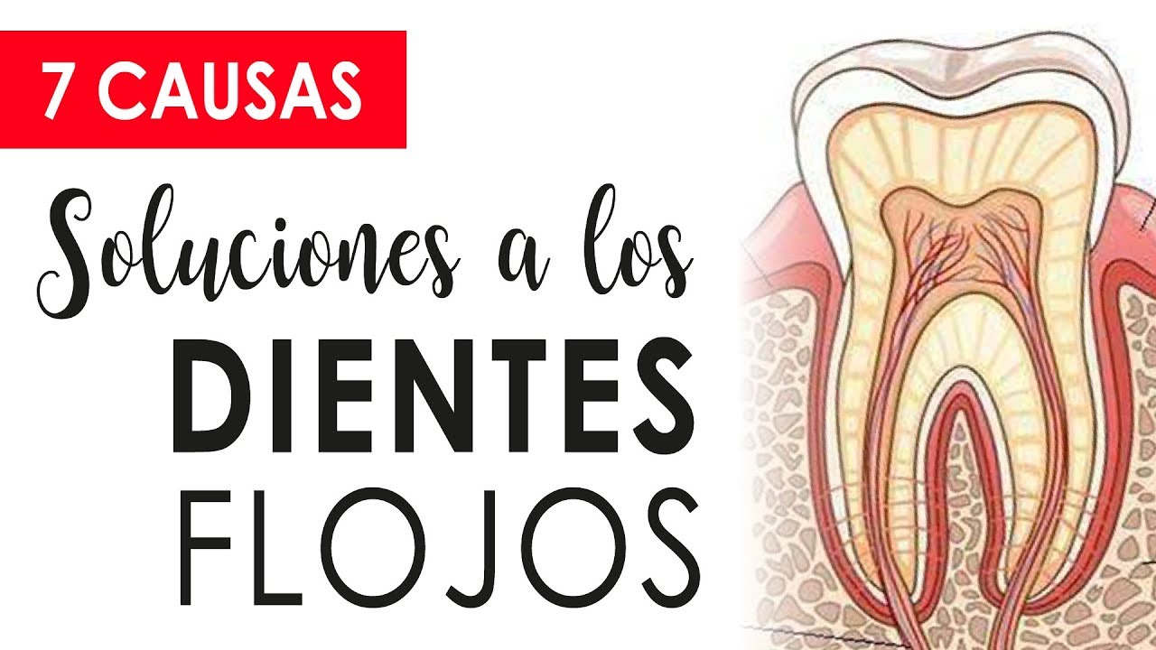 cuanto tarda en caerse una muela floja