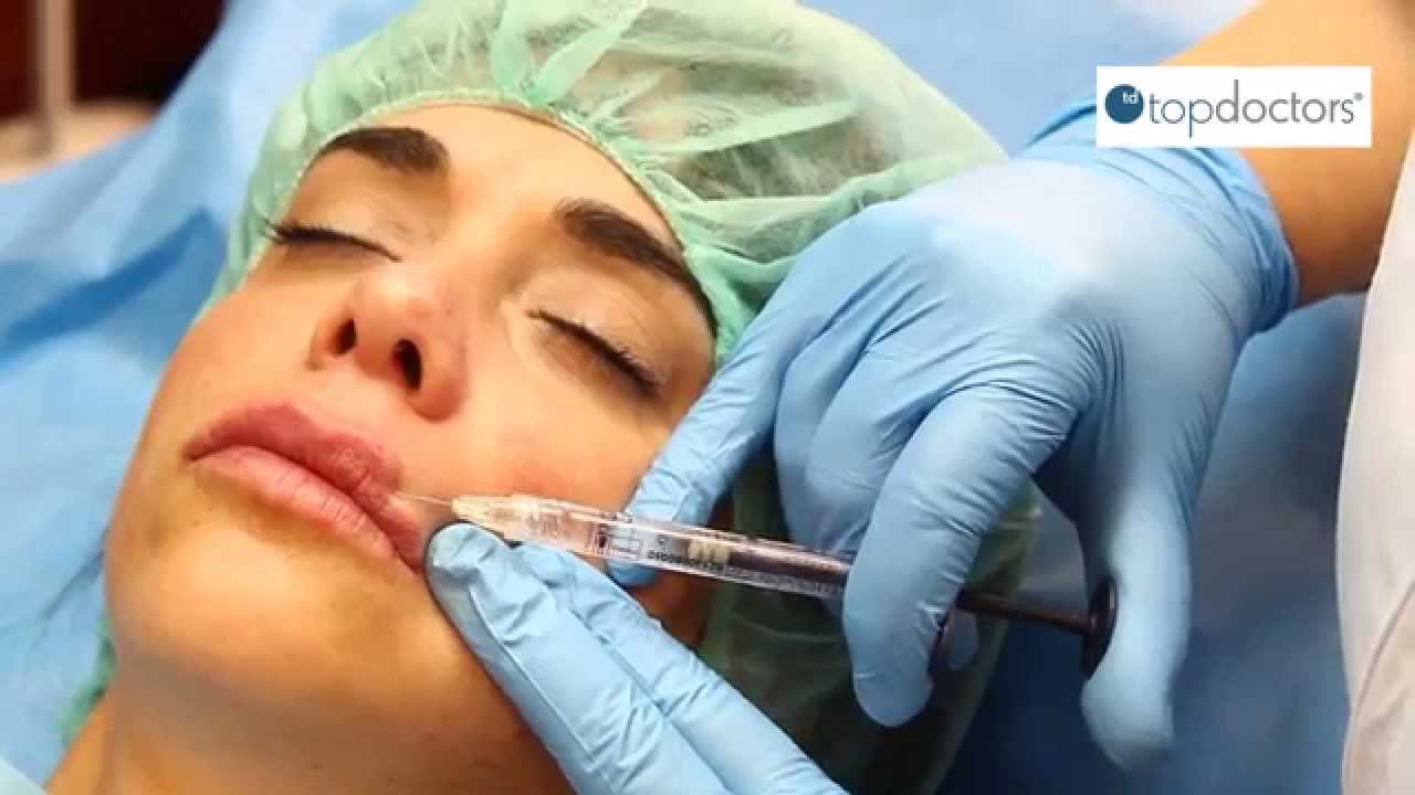 cuanto vale ponerse acido hialuronico en los labios