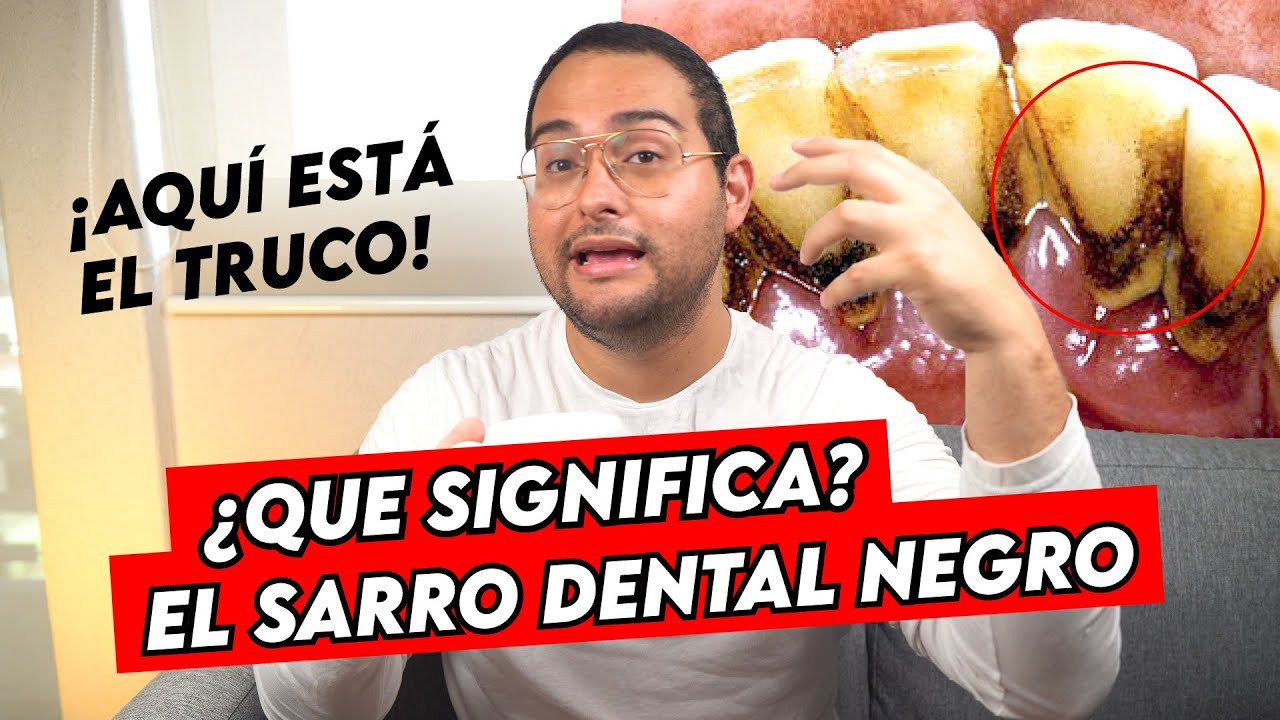 de que color es el sarro de los dientes