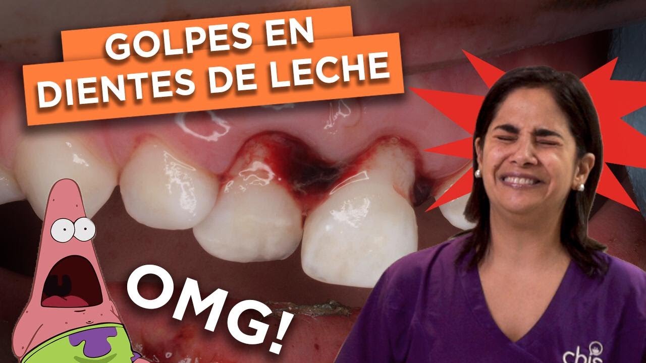 diente de leche gris por golpe