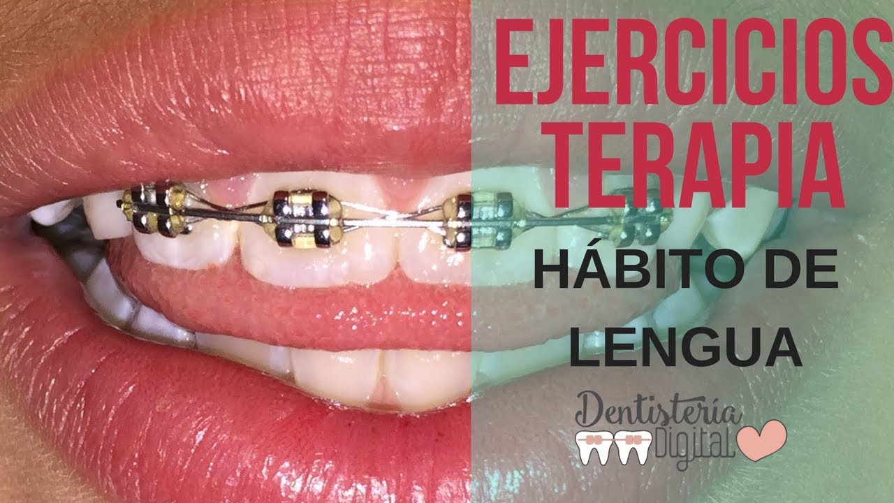 ejercicios para no empujar los dientes con la lengua