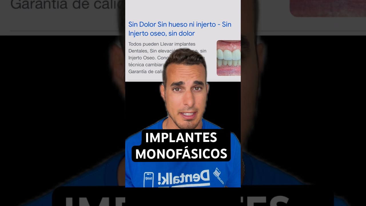 implantes dentales sin hueso maxilar inferior