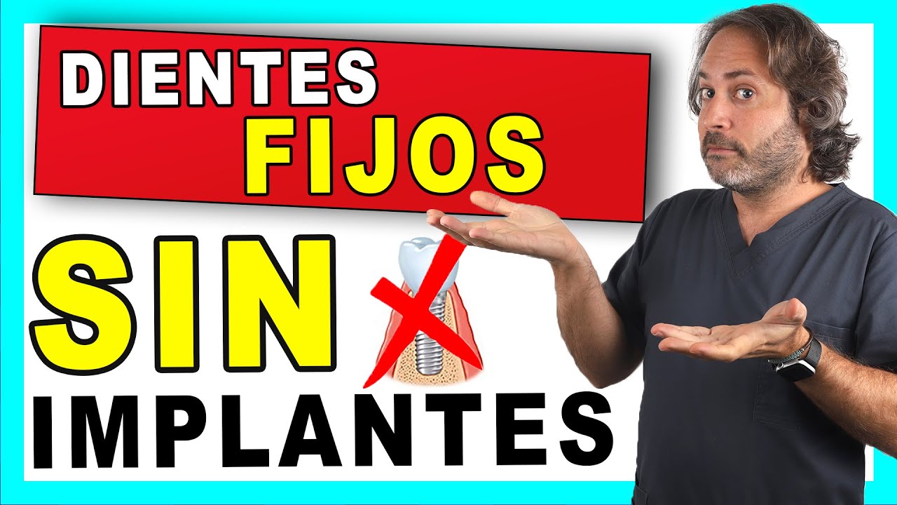 lo último en prótesis dentales fijas