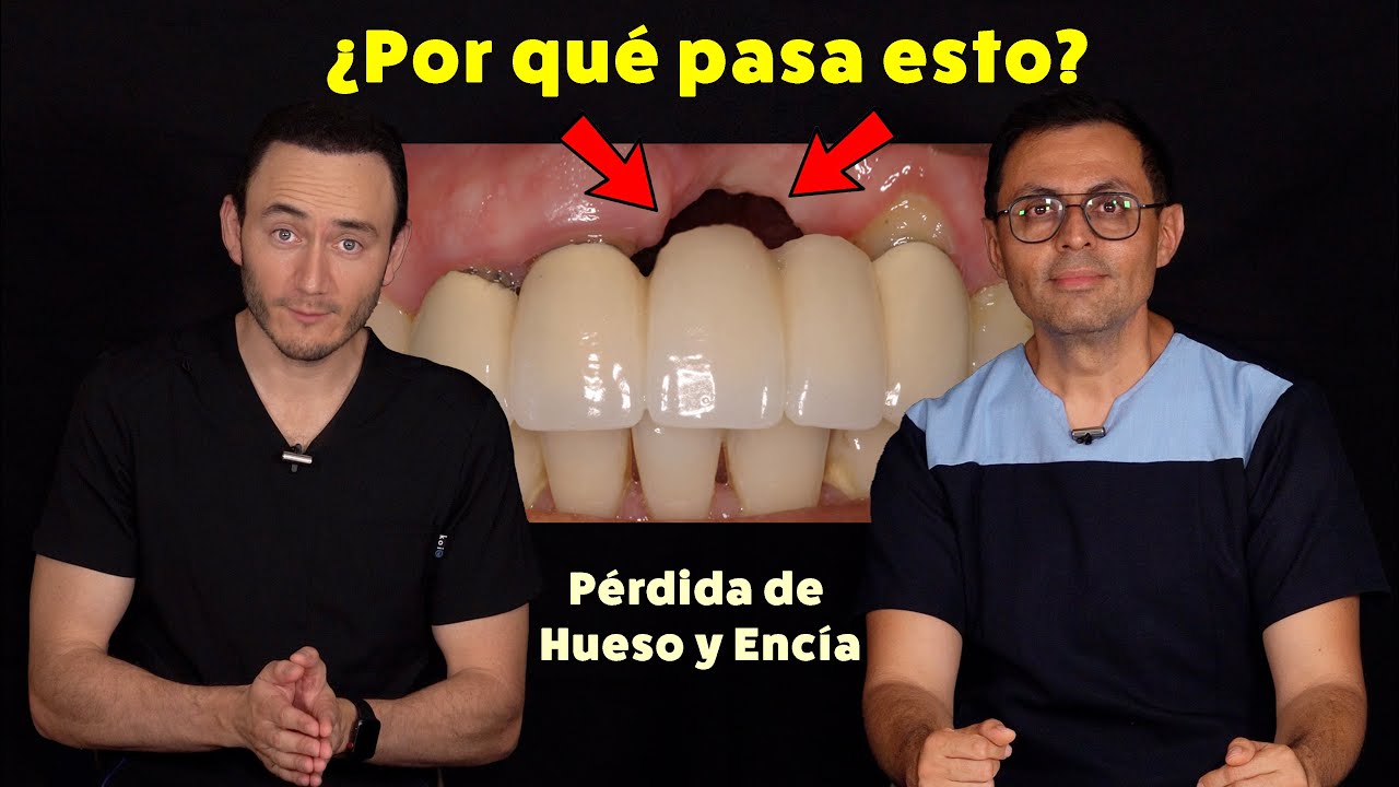 pérdida de hueso en la encía solución