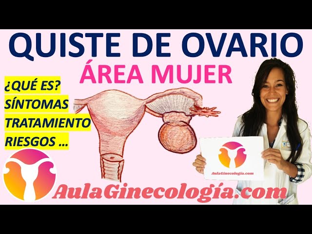 porque salen los quistes de agua