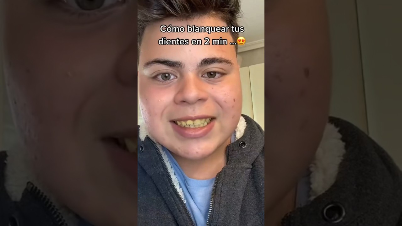 que hacer para blanquear los dientes