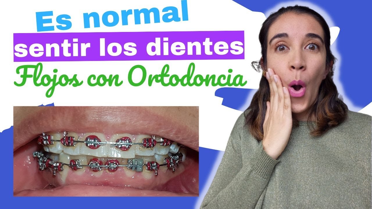 se pueden caer los dientes con ortodoncia