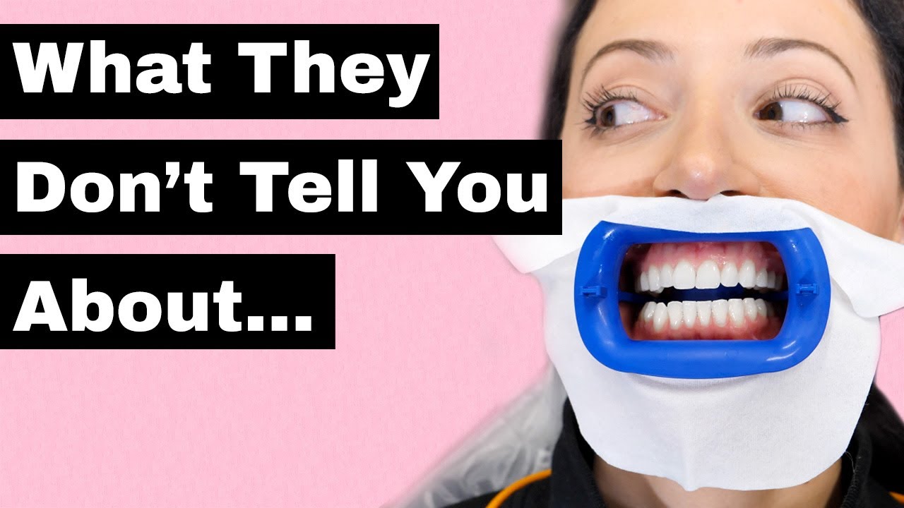 side effects of led teeth whitening