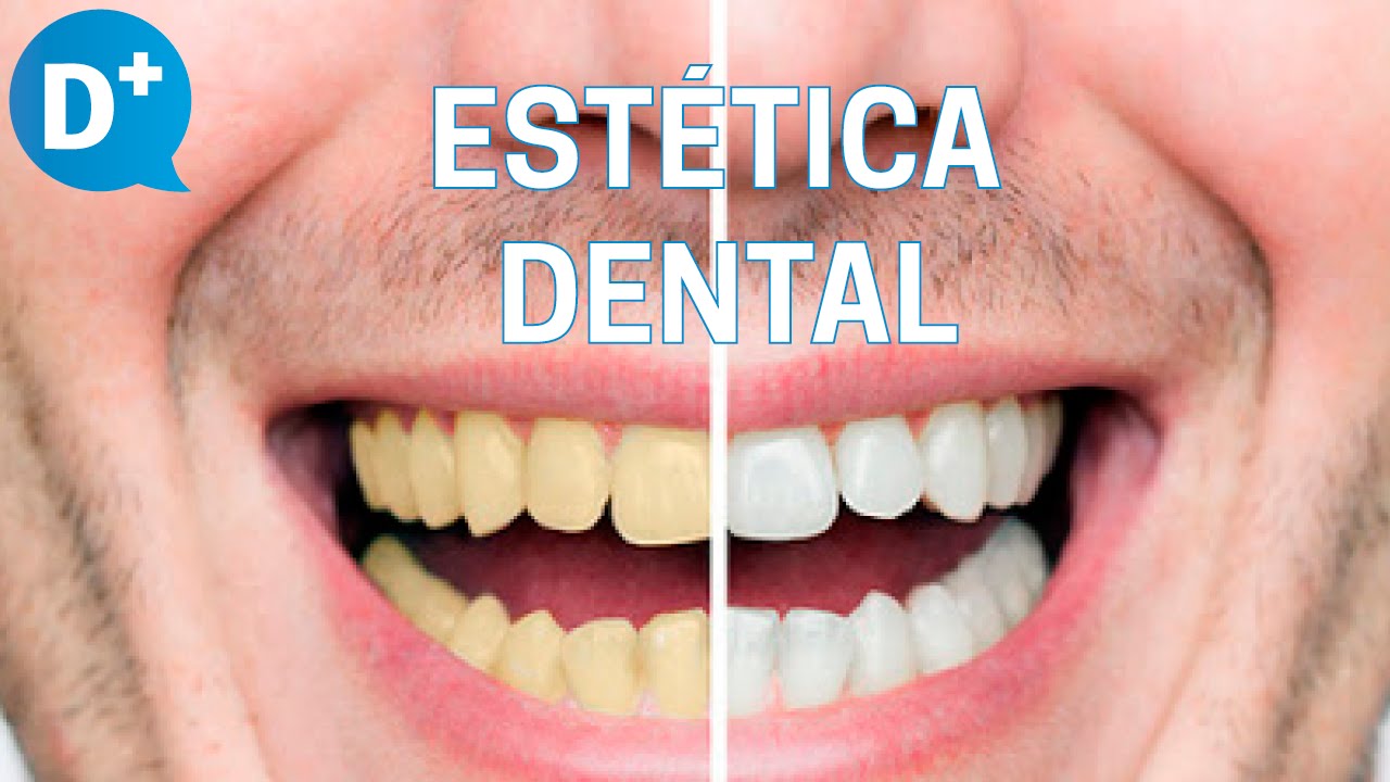 tipos de tratamientos para los dientes