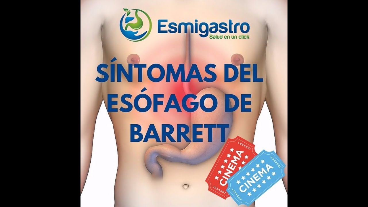 valvula entre el esofago y estomago