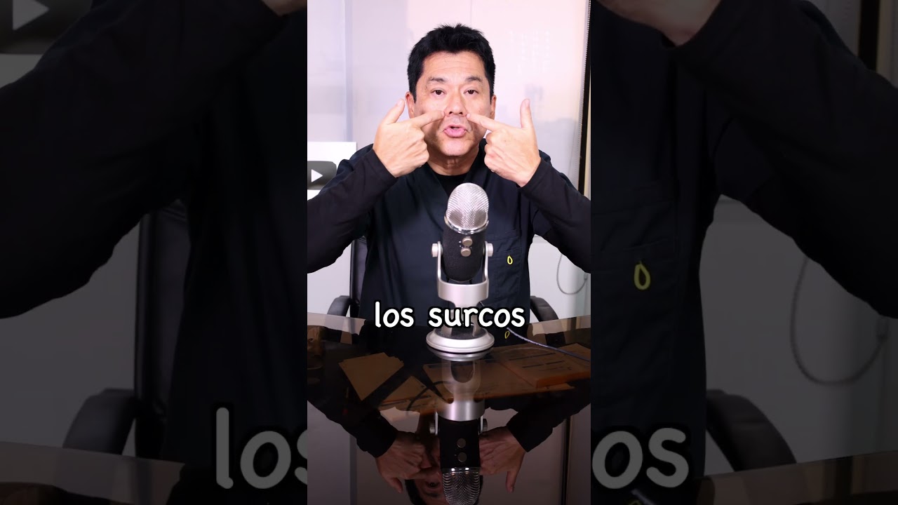 ácido hialurónico surco nasogeniano antes y después