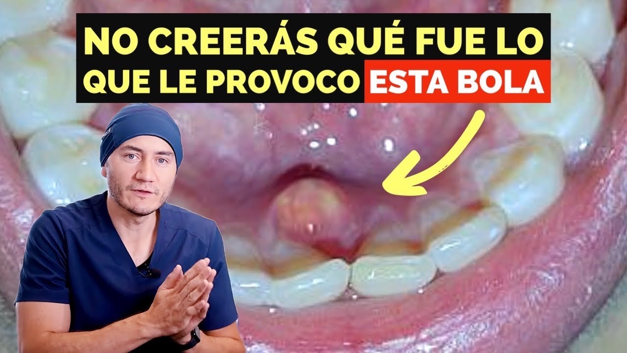 bolitas detras de los dientes de abajo
