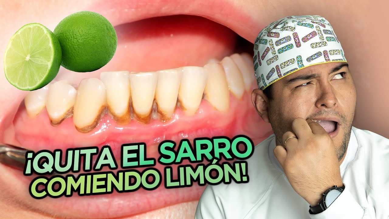 como eliminar el sarro delos dientes