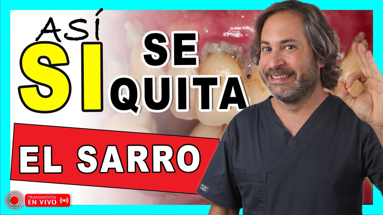 como limpiar los dientes de sarro