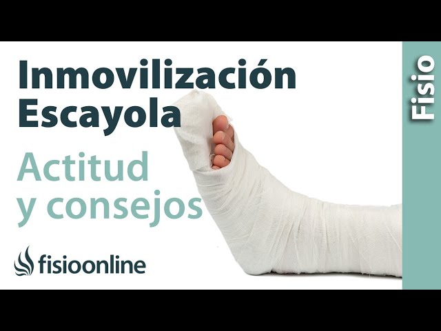 como saber si una férula está bien puesta