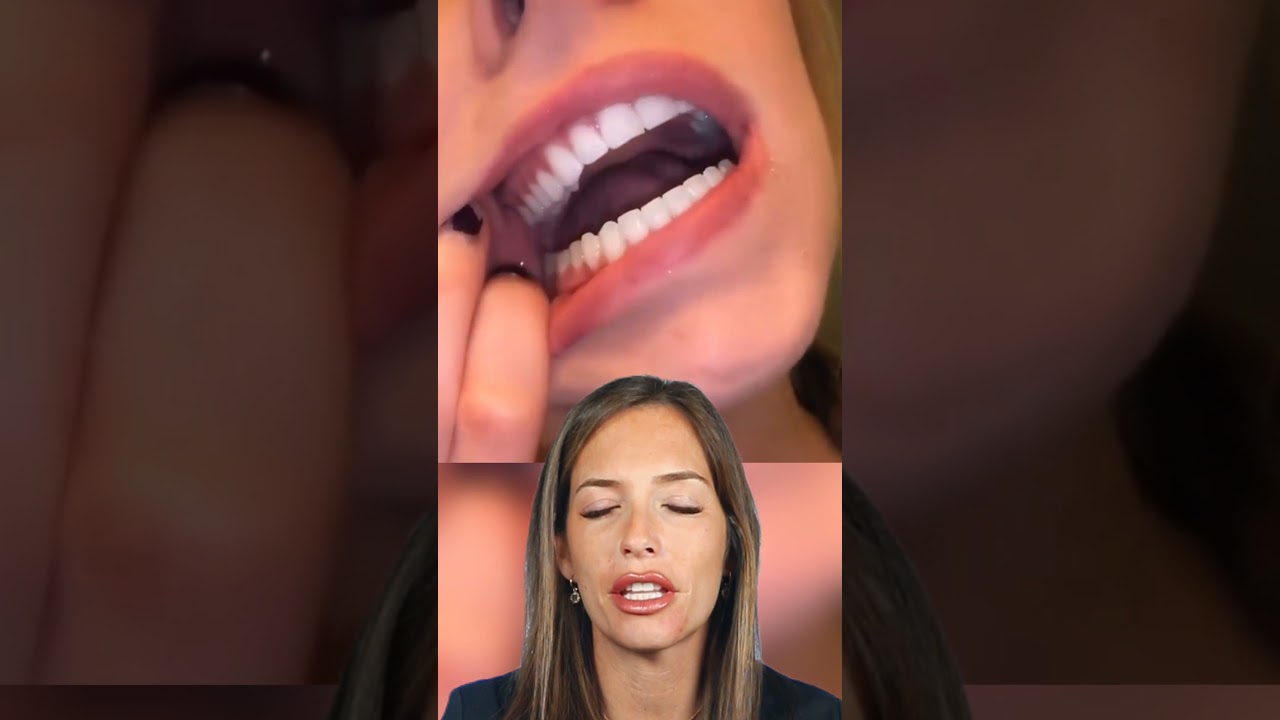 como se ve una mordida correcta