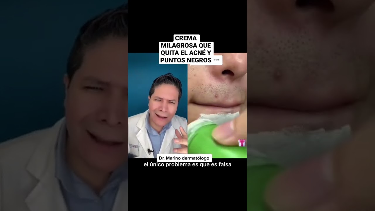 crema para quitar granos al instante
